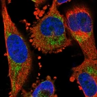 Immunofluorescent staining of human cell line U-251 MG shows localization to cytosol & mitochondria.