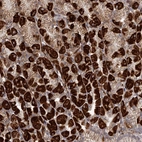 Anti-RRP36 Antibody