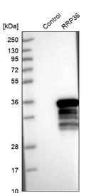 Western blot analysis in control (vector only transfected HEK293T lysate) and RRP36 over-expression lysate (Co-expressed with a C-terminal myc-DDK tag (~3.1 kDa) in mammalian HEK293T cells, LY409717).