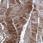 Immunohistochemical staining of human skeletal muscle shows strong cytoplasmic positivity in myocytes.