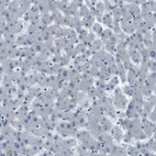 Immunohistochemical staining of human liver shows no positivity in hepatocytes as expected.