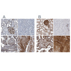 Immunohistochemical staining of human kidney, liver, placenta and skeletal muscle using Anti-PLEC antibody HPA029906 (A) shows similar protein distribution across tissues to independent antibody HPA025967 (B).