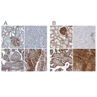 Immunohistochemical staining of human kidney, liver, placenta and skeletal muscle using Anti-PLEC antibody HPA029906 (A) shows similar protein distribution across tissues to independent antibody HPA025967 (B).