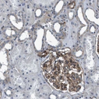 Immunohistochemical staining of human kidney shows moderate membranous positivity in cells in glomeruli.