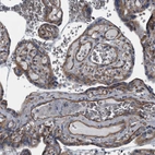 Immunohistochemical staining of human placenta shows moderate membranous positivity in trophoblastic cells.