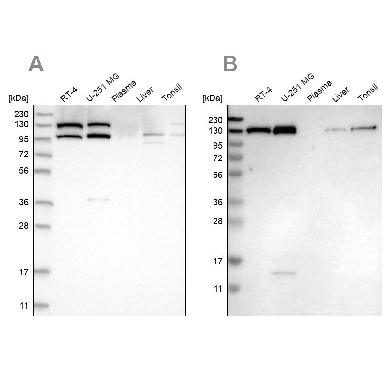 Anti-XPO5 Antibody