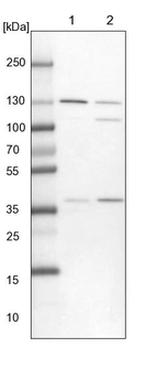 Lane 1: NIH-3T3 cell lysate (Mouse embryonic fibroblast cells)_br/_Lane 2: NBT-II cell lysate (Rat Wistar bladder tumour cells)