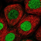 Immunofluorescent staining of human cell line A-431 shows localization to nucleoplasm.