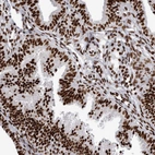 Immunohistochemical staining of human fallopian tube shows strong nuclear positivity in glandular cells.