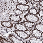 Immunohistochemical staining of human rectum shows strong nuclear positivity in glandular cells.