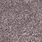 Immunohistochemical staining of human tonsil shows strong nuclear positivity in non-germinal center cells and germinal center cells.