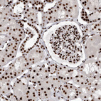 Immunohistochemical staining of human kidney shows strong nuclear positivity in cells in tubules and cells in glomeruli.
