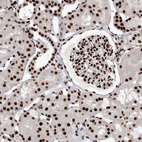 Anti-NUMA1 Antibody