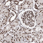 Immunohistochemical staining of human kidney shows strong nuclear positivity in cells in tubules and cells in glomeruli.