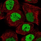 Immunofluorescent staining of human cell line A-431 shows localization to nucleoplasm.