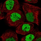Immunofluorescent staining of human cell line A-431 shows localization to nucleoplasm.