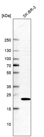 Western blot analysis in human cell line SK-BR-3.