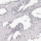 Immunohistochemical staining of human prostate shows low expression as expected.