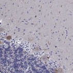 Anti-PLXNA4 Antibody