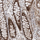 Anti-C1orf131 Antibody