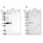 Western blot analysis using Anti-C1orf131 antibody HPA029920 (A) shows similar pattern to independent antibody HPA028452 (B).
