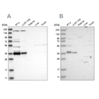 Western blot analysis using Anti-C1orf131 antibody HPA029920 (A) shows similar pattern to independent antibody HPA028452 (B).