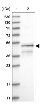 Lane 1: Marker [kDa] 230, 130, 95, 72, 56, 36, 28, 17, 11_br/_Lane 2: Human cell line RT-4
