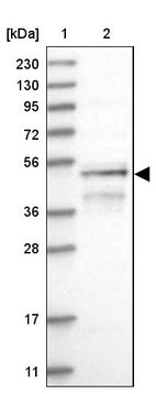 Lane 1: Marker [kDa] 230, 130, 95, 72, 56, 36, 28, 17, 11_br/_Lane 2: Human cell line RT-4