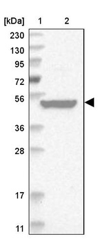 Anti-RUSC1 Antibody