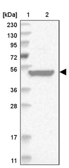 Lane 1: Marker [kDa] 230, 130, 95, 72, 56, 36, 28, 17, 11_br/_Lane 2: Human cell line RT-4