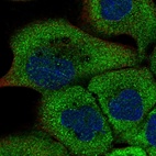Immunofluorescent staining of human cell line A-431 shows localization to cytosol.