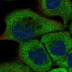 Immunofluorescent staining of human cell line A-431 shows localization to cytosol.
