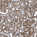 Immunohistochemical staining of human kidney shows moderate to strong cytoplasmic positivity in cells in tubules.