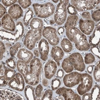 Immunohistochemical staining of human kidney shows moderate to strong cytoplasmic positivity in cells in tubules.