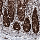 Immunohistochemical staining of human rectum shows strong cytoplasmic positivity in glandular cells.