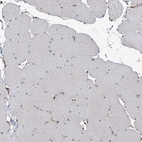Immunohistochemical staining of human skeletal muscle shows no positivity in myocytes as expected.