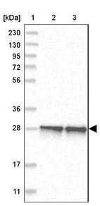 Lane 1: Marker [kDa] 230, 130, 95, 72, 56, 36, 28, 17, 11_br/_Lane 2: Human cell line RT-4_br/_Lane 3: Human cell line U-251MG sp