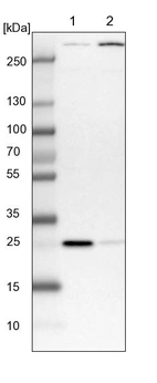 Lane 1: NIH-3T3 cell lysate (Mouse embryonic fibroblast cells)_br/_Lane 2: NBT-II cell lysate (Rat Wistar bladder tumour cells)