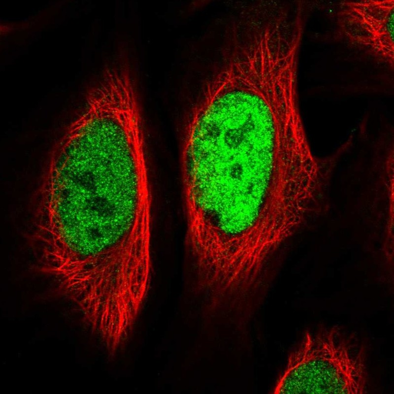 Anti-EGR1 Antibody
