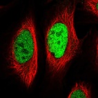 Anti-EGR1 Antibody