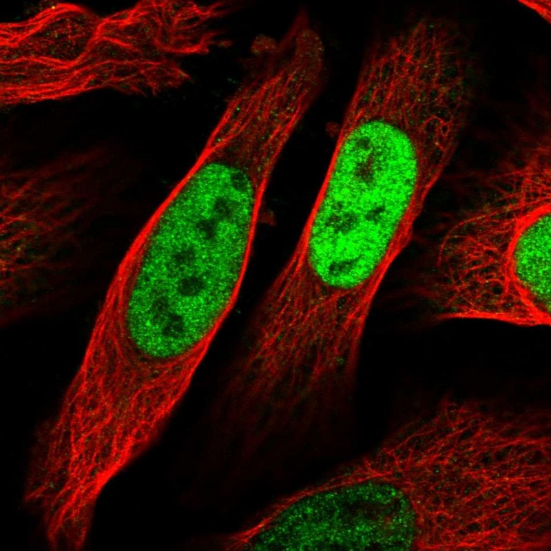 Anti-EGR1 Antibody