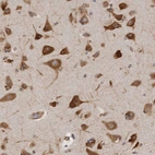 Immunohistochemical staining of human cerebral cortex strong cytoplasmic positivity in neurons.