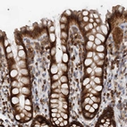 Immunohistochemical staining of human rectum shows strong cytoplasmic positivity in glandular cells.