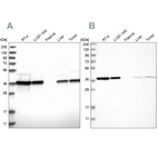 Western blot analysis using Anti-EIF3I antibody HPA029939 (A) shows similar pattern to independent antibody HPA029940 (B).