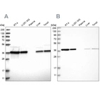 Western blot analysis using Anti-EIF3I antibody HPA029939 (A) shows similar pattern to independent antibody HPA029940 (B).