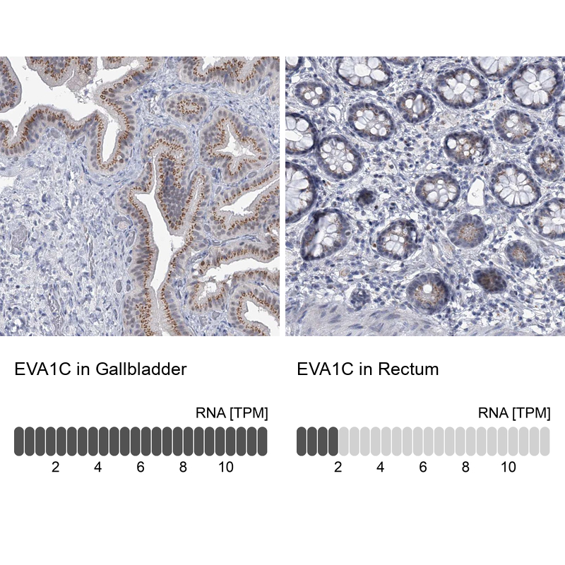 Anti-EVA1C Antibody