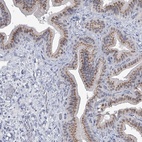 Anti-EVA1C Antibody