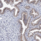 Immunohistochemical staining of human gallbladder shows high expression.