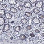 Immunohistochemical staining of human rectum shows low expression as expected.