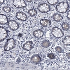 Immunohistochemical staining of human rectum shows low expression as expected.